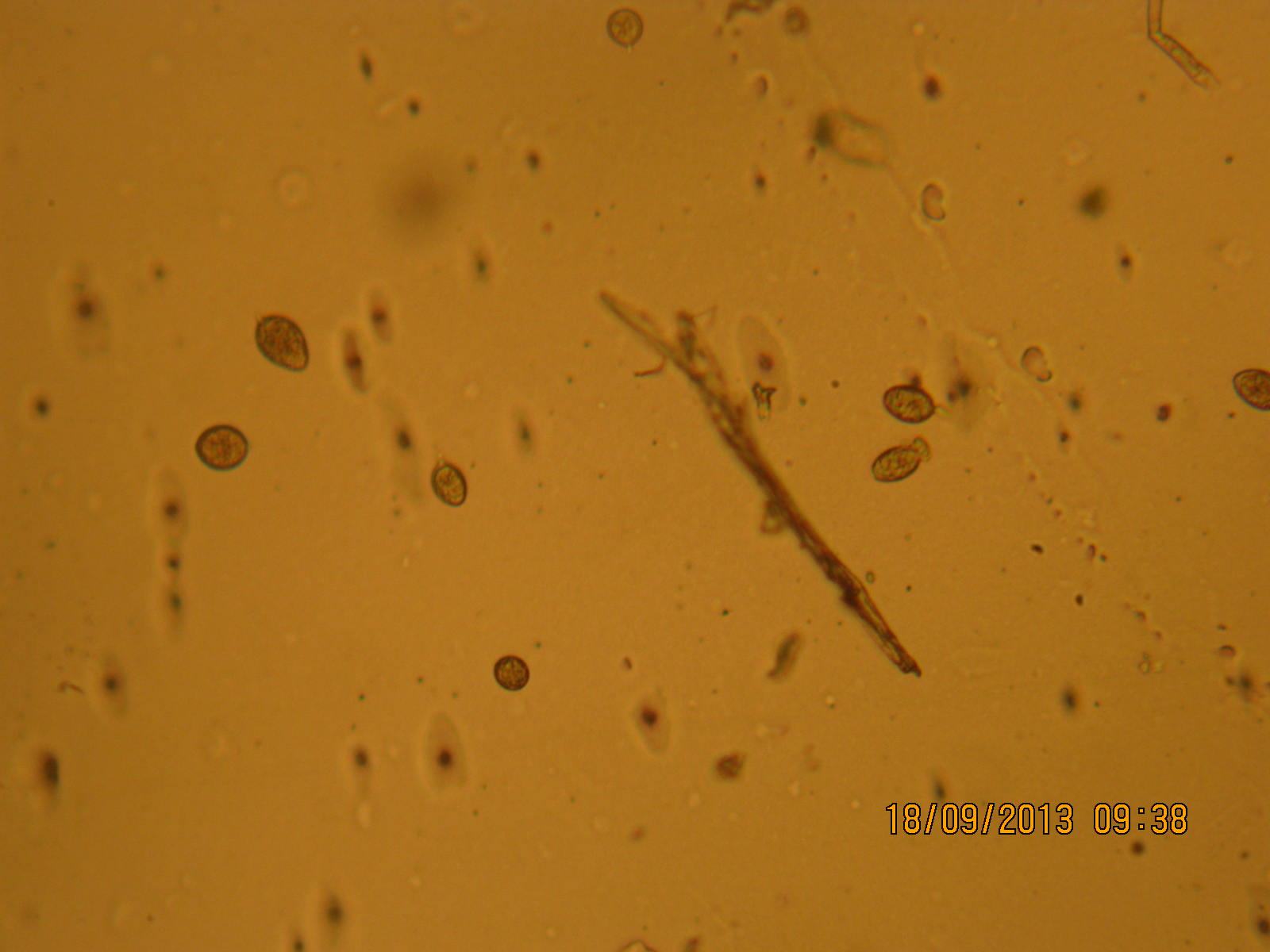 image microscopique par objectif X10 = conidiocystes de Phytophthora 