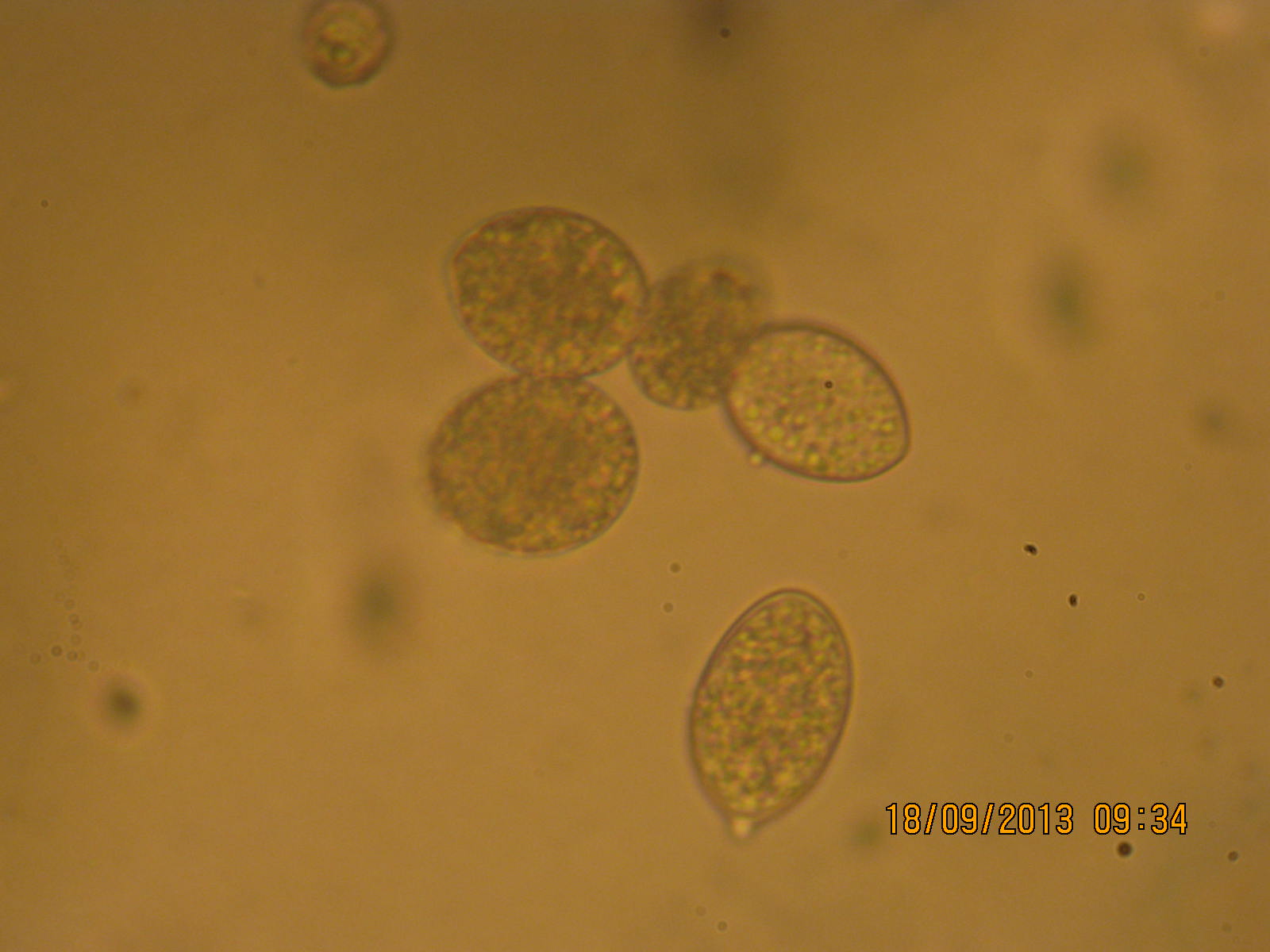 image microscopique par objectif X40 = conidiocystes de Phytophthora 