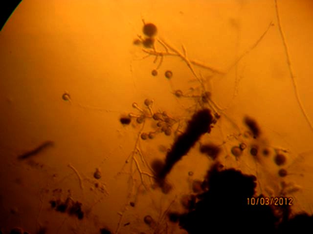 examen � l'objectif 10